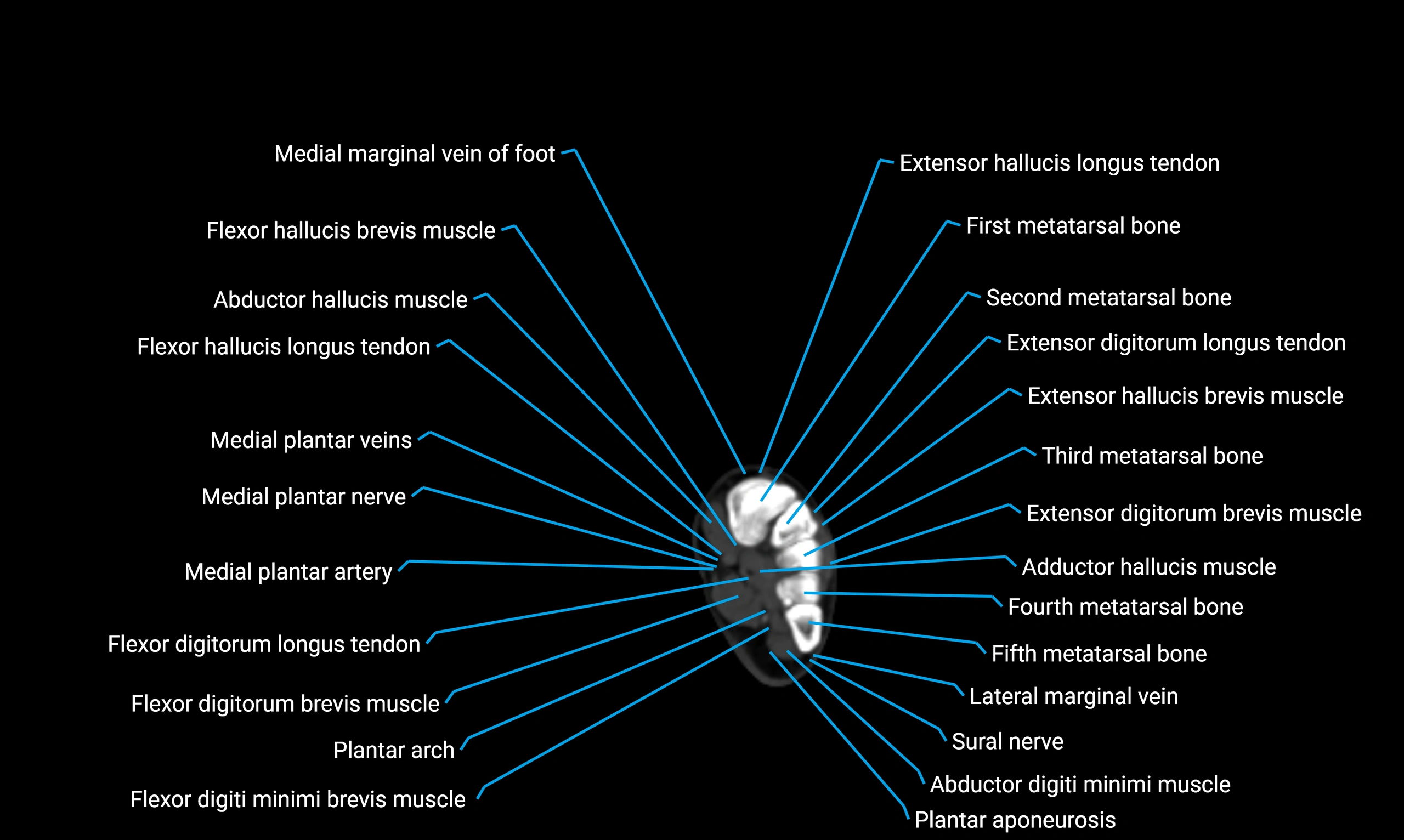 CT lower limb axial cross sectional anatomy labelled image 182 (2).webp